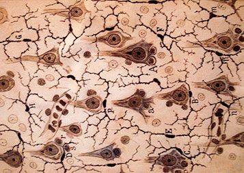 Dieses Präparat stammt von Santiago Ramon y Cajal und zeigt Mikroglia in der menschlichen Großhirnrinde. © Luciana Christante