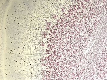 Durch eine Färbetechnik, die mit Silbernitrat arbeitet, sind die Axone und die Zellkörper der Neurone im Kleinhirn deutlich sichtbar. © Oliver von Bohlen und Halbach/ Universität Greifswald 