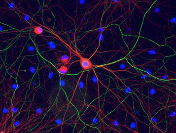 Neuronen und Gliazellen