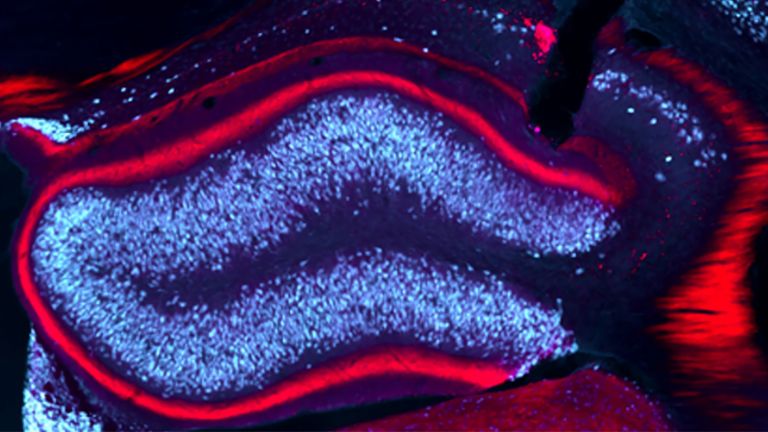 Bei einer langsamen Stimulation des Hippocampus blieben im Mausmodell die epileptischen Anfälle aus.