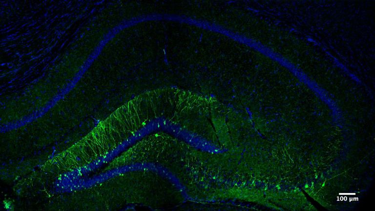 Die Abbildung zeigt den Teil des Hippocampus einer Maus, der beim Erlernen der neuen Aufgabe aktiviert wird. In grüner Farbe erscheinen die Neuronen, die die spezifische Erinnerung an diese Aufgabe codieren.